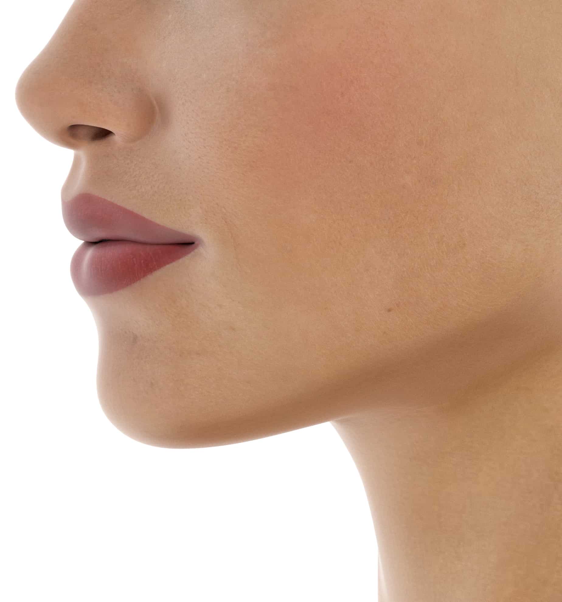 Face Lift vs Brow Lift